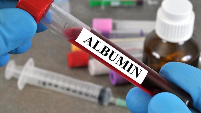 Artikel 2 - Apa Itu Albumin - Gambar Ilustrasi Albumin